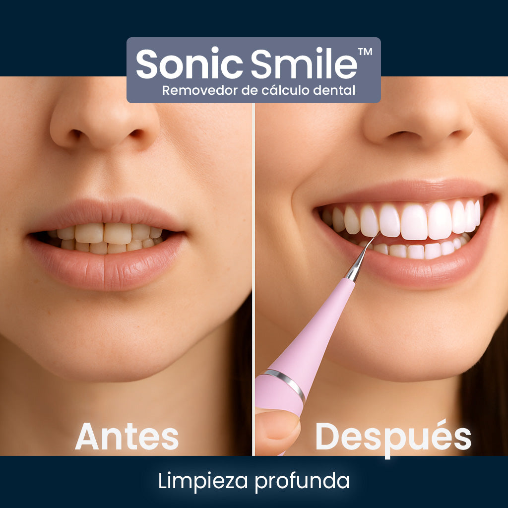 Sonic Smile| Limpiador bucal profesional